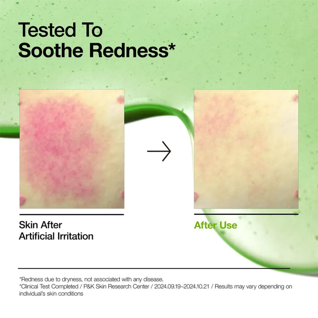 Anua Azelaic Acid 10 Hyaluron Redness Soothing Serum - 30ml Face Serum - XOXO cosmetics