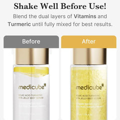 Medicube Kojic Acid Turmeric Vita Jelly Mist Serum - 100ml Face Serum - XOXO cosmetics