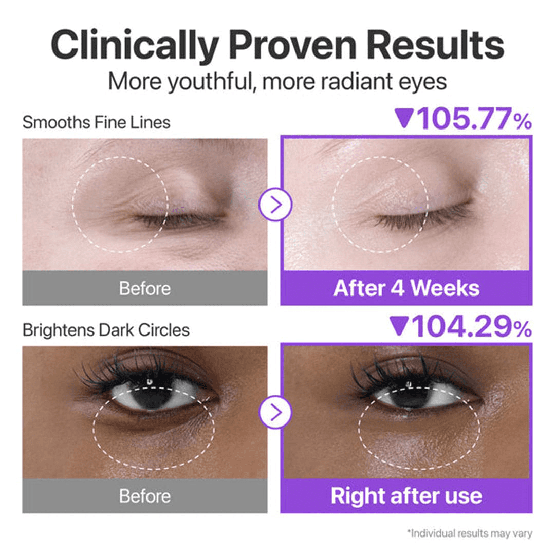Numbuzin NAD+ Retinol Volumetox Eye Cream - 10ml Eye Care - XOXO cosmetics