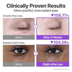 Numbuzin NAD+ + Retinol Volumetox Eye Cream - 10ml Eye Care - XOXO cosmetics