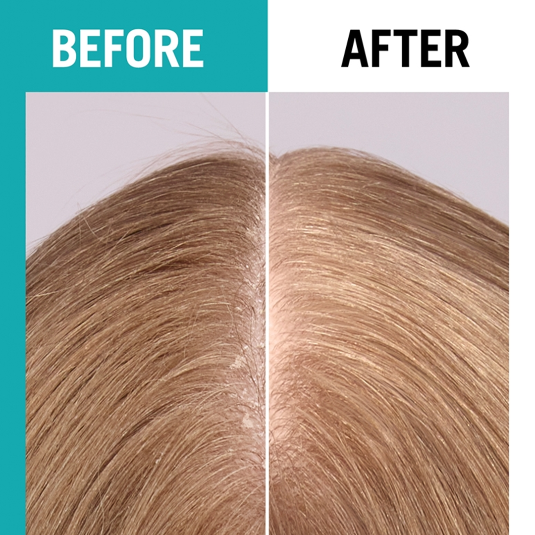 Schwarzkopf Gliss scalp balance Hyddrating Serum - 100ml