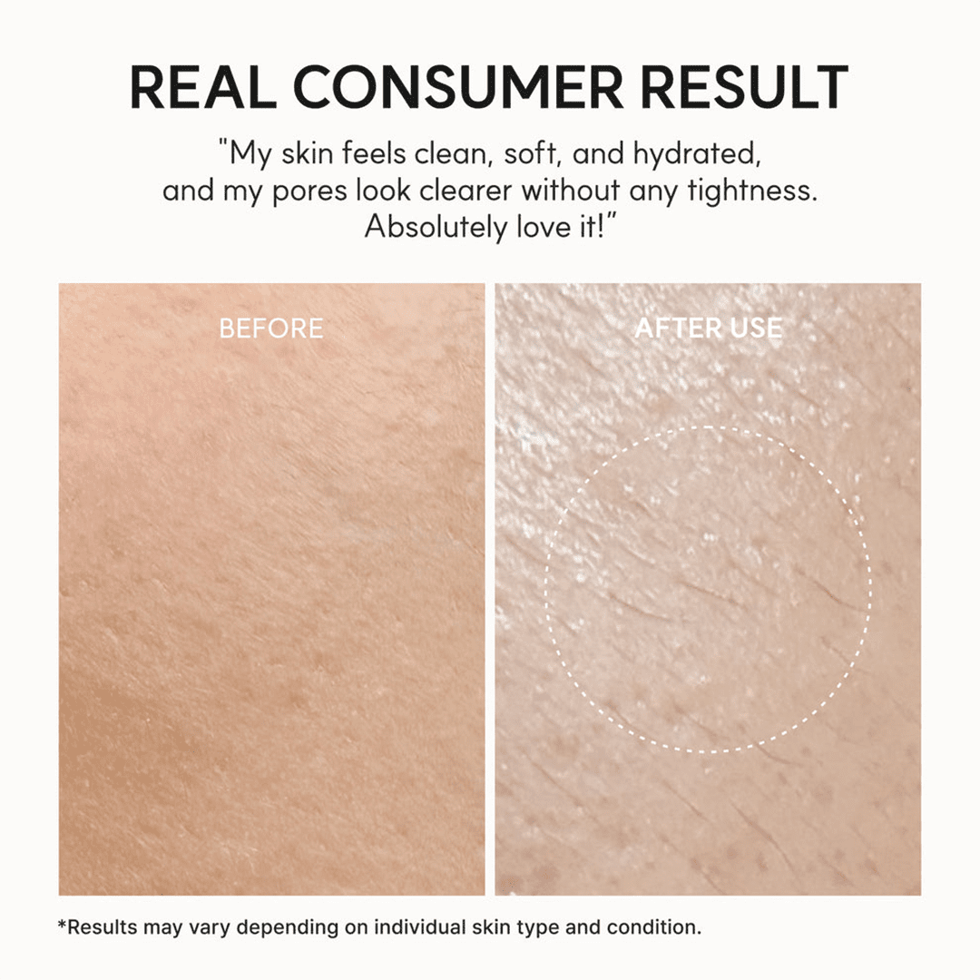 Arencia Fresh Rosehip Rice Mochi Cleanser - 120g Cleanser - XOXO cosmetics
