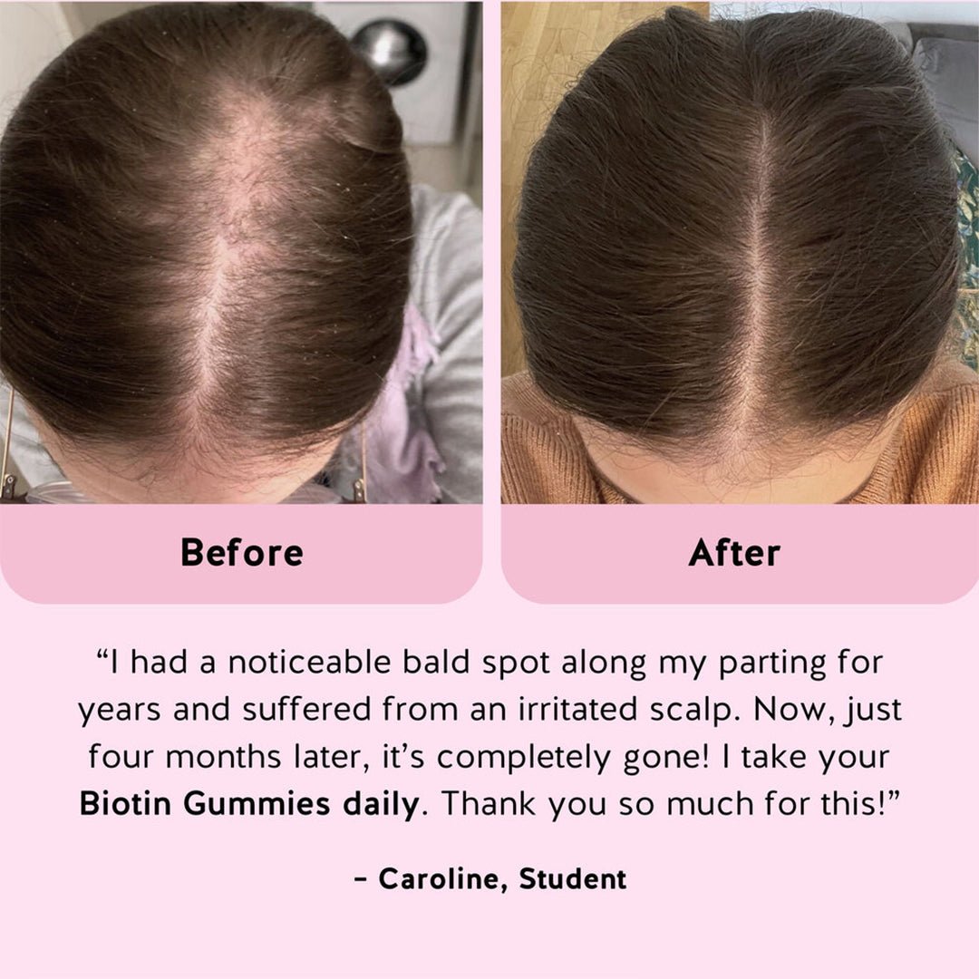 Bears Benefits AH-MAZING Hair Vitamins Biotin - 45 Pcs Hair Supplement - XOXO cosmetics