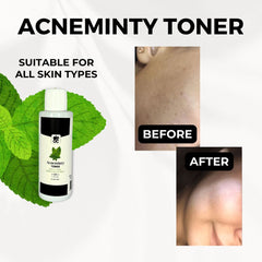 DEOC. Acneminty Toner - 120ml Toner - XOXO cosmetics