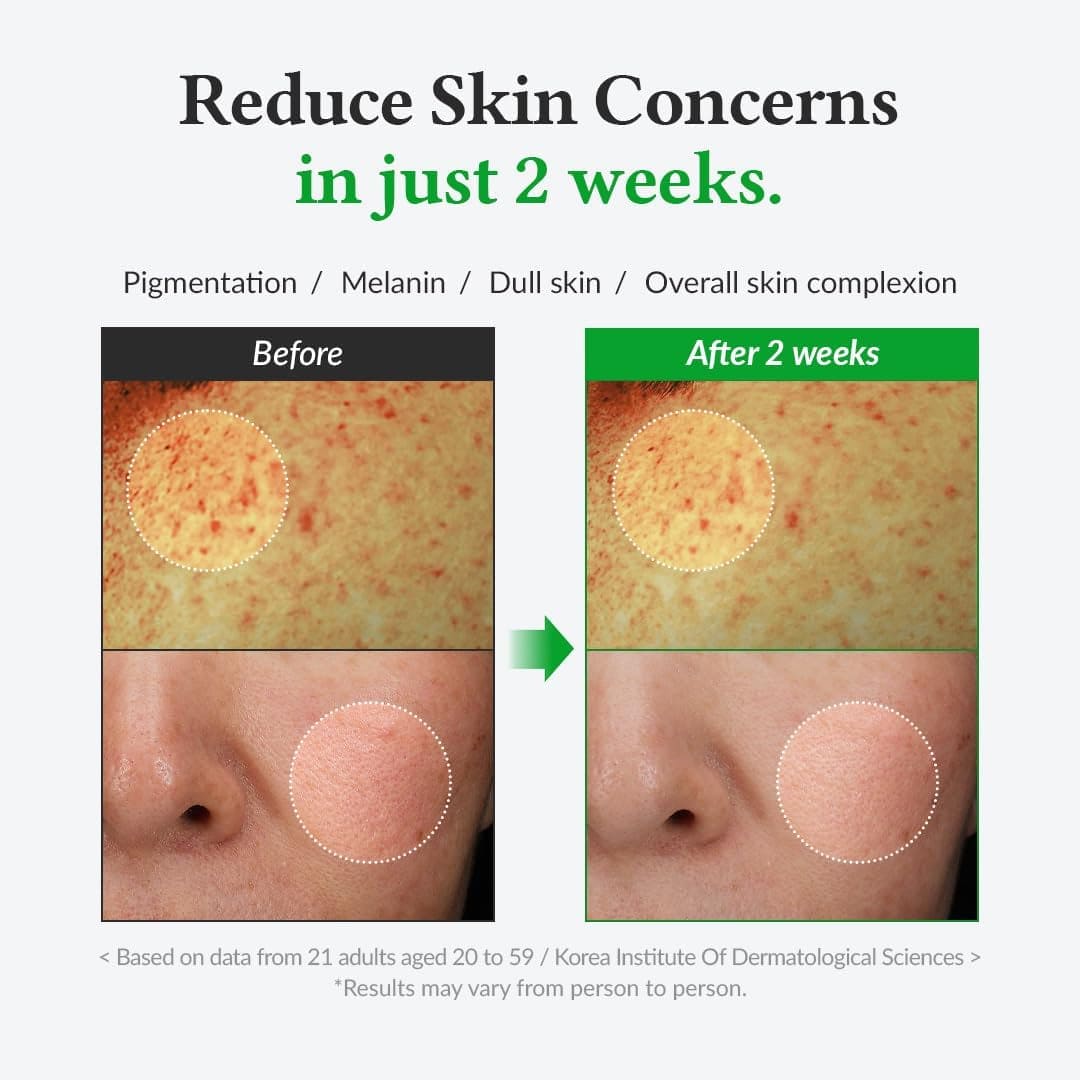 Dr. Althea Gentle Vitamin C Serum - 30ml Face Serum - XOXO cosmetics