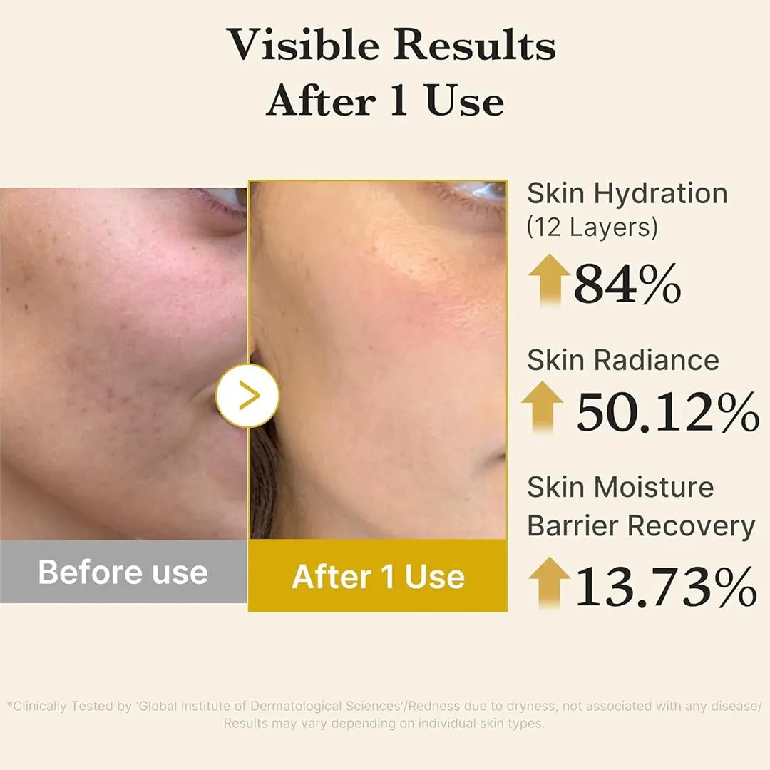 Medicube Kojic Acid Turmeric Vita Jelly Mist Serum - 100ml Face Serum - XOXO cosmetics