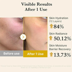 Medicube Kojic Acid Turmeric Vita Jelly Mist Serum - 100ml Face Serum - XOXO cosmetics