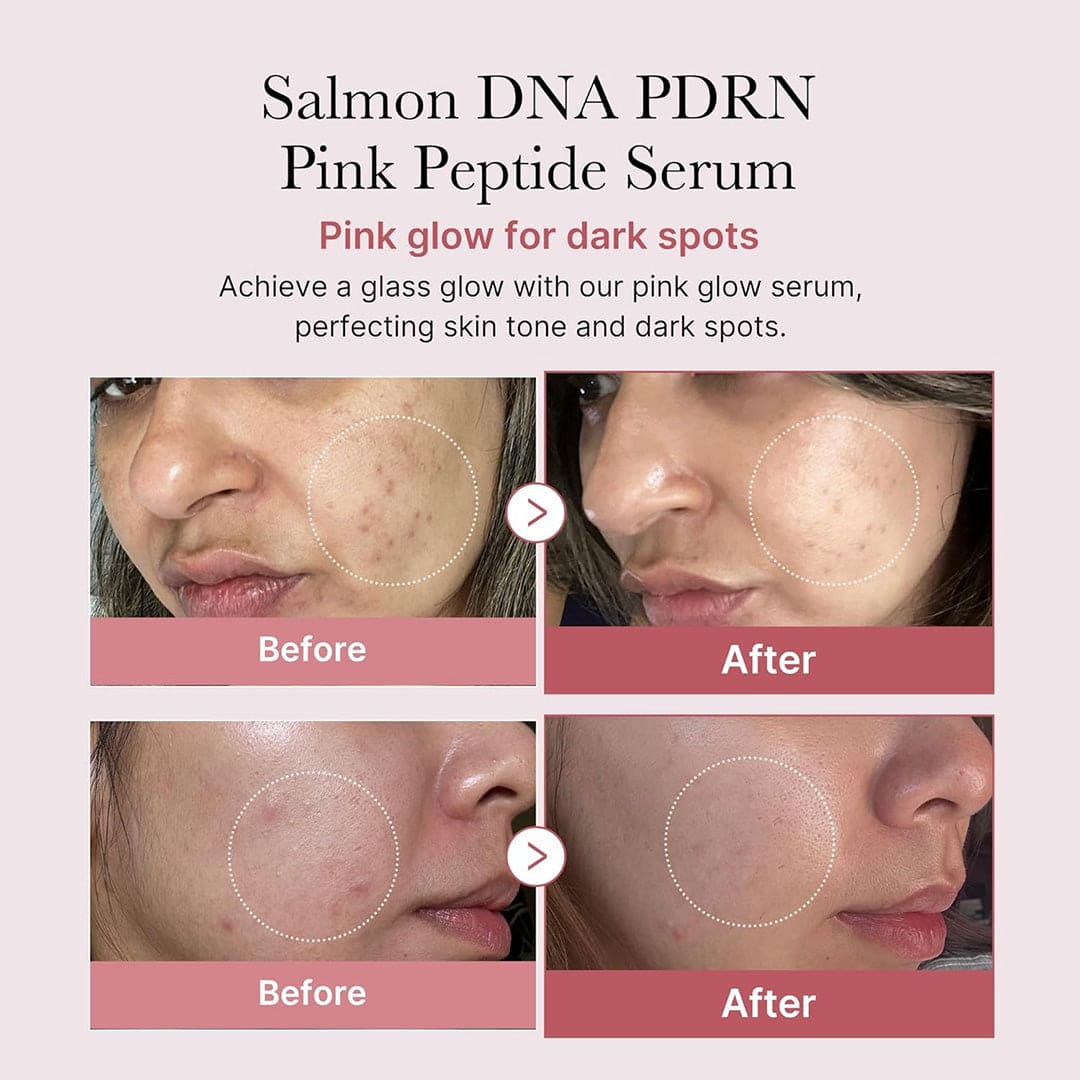Medicube PDRN Pink Peptide Serum - 30ml Face Serum - XOXO cosmetics