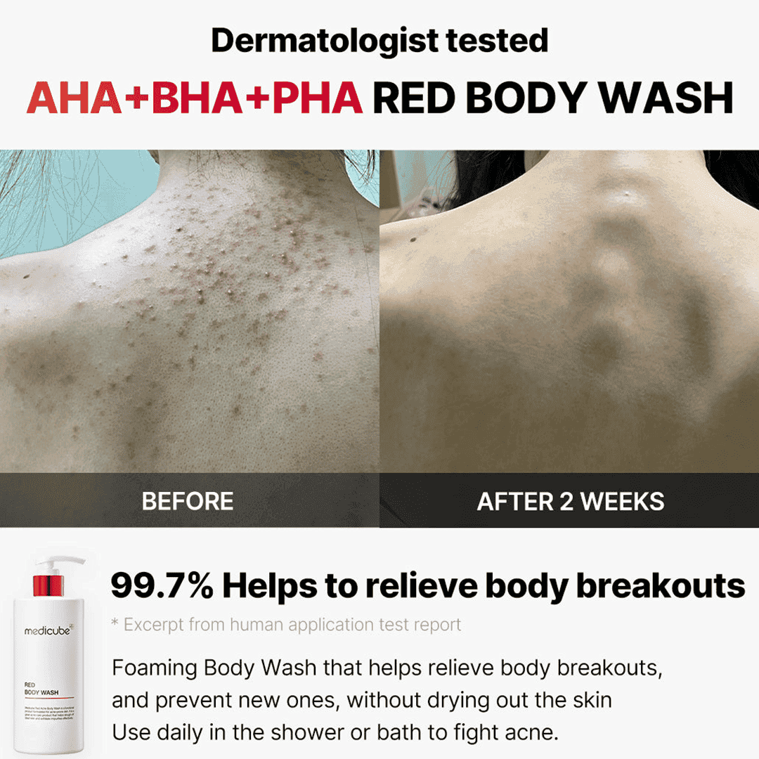 Medicube Red Acne Body Wash - 400g Shower Gel - XOXO cosmetics