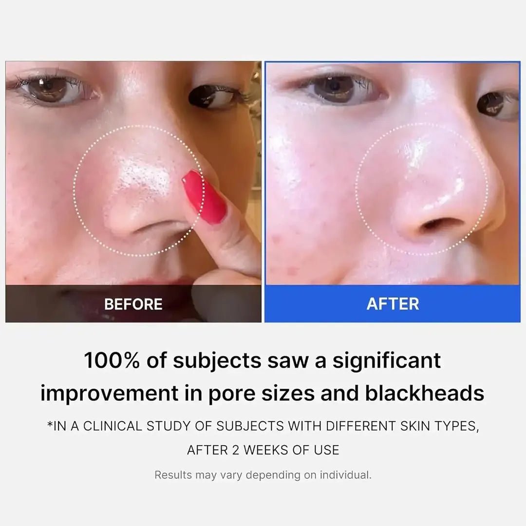 Medicube Zero Pore Pad Mild - 155g Face toner - XOXO cosmetics