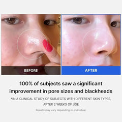 Medicube Zero Pore Pad Mild - 155g Face toner - XOXO cosmetics