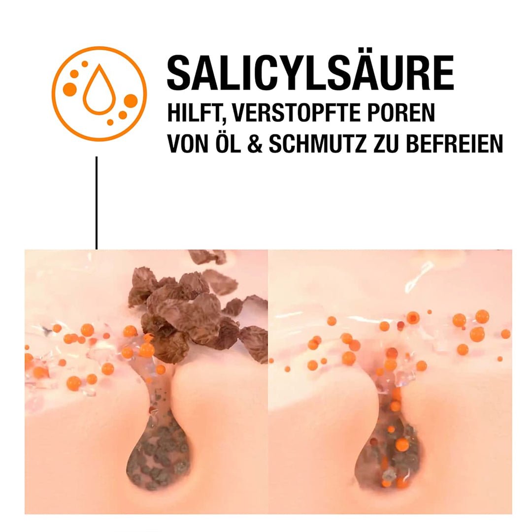 Neutrogena Anti-Pickel SOS Soforthilfe-Gel Salicylic cream - XOXO cosmetics