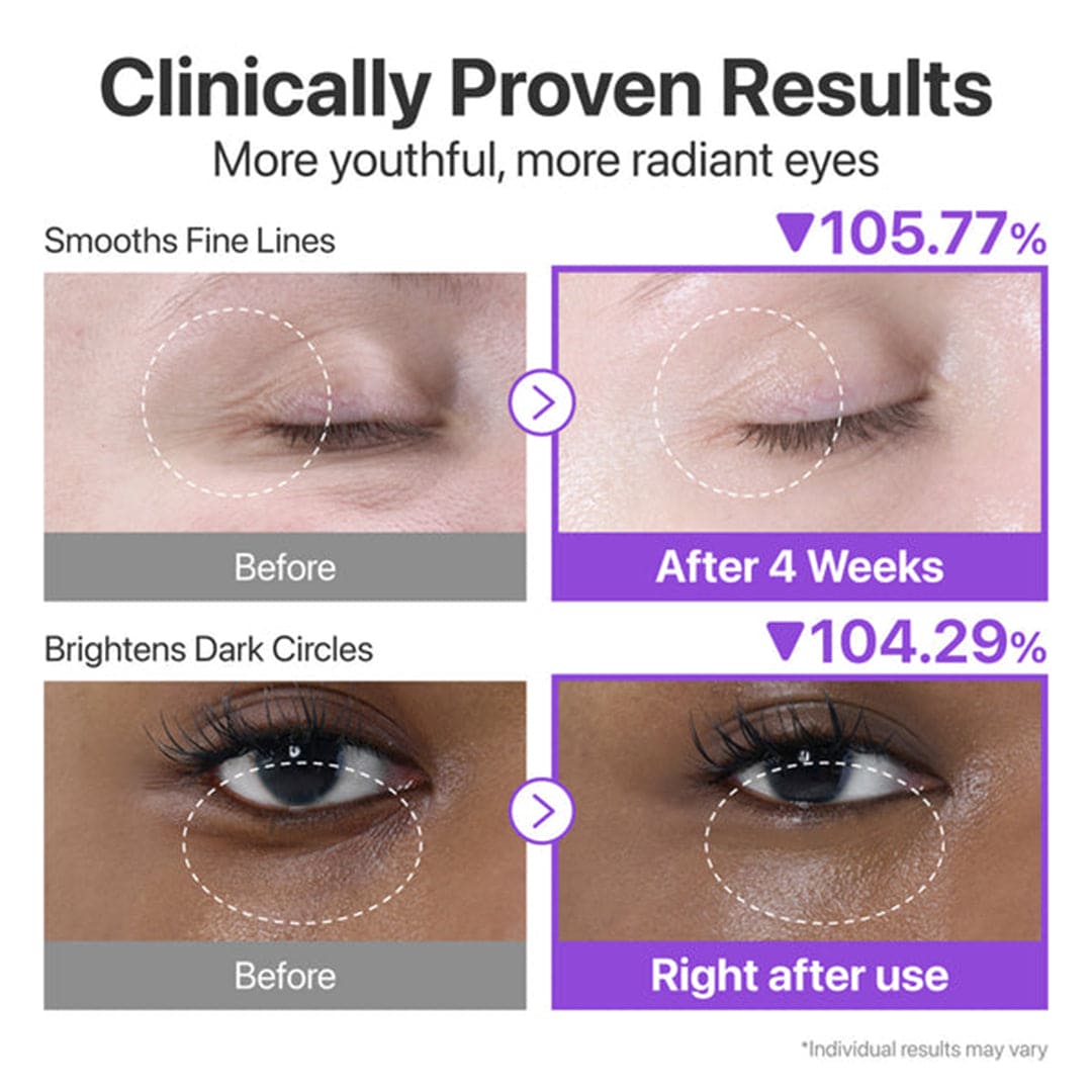 Numbuzin NAD+ + Retinol Volumetox Eye Cream - 10ml Eye Care - XOXO cosmetics