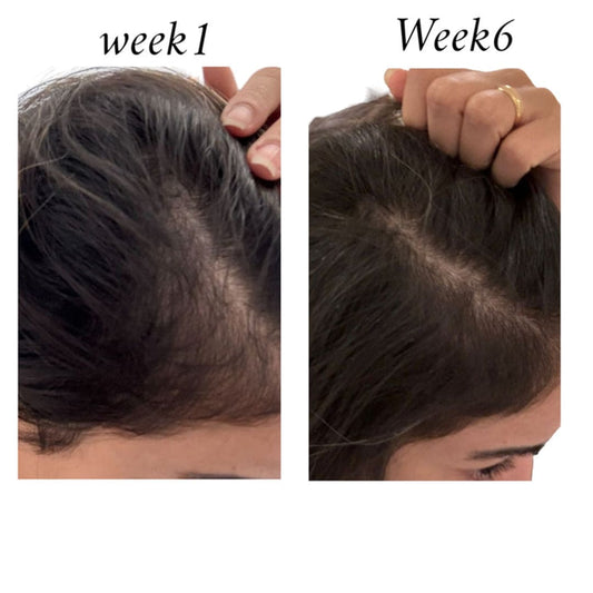 Raw African Follicle Booster Redensyl Daily Spray Hair Treatment - XOXO cosmetics