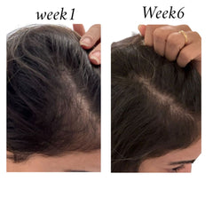 Raw African Follicle Booster Redensyl Daily Spray Hair Treatment - XOXO cosmetics