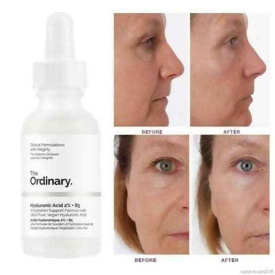 The Ordinary Hyaluronic Acid 2% + B5 - 30ml Moisturizer - XOXO cosmetics