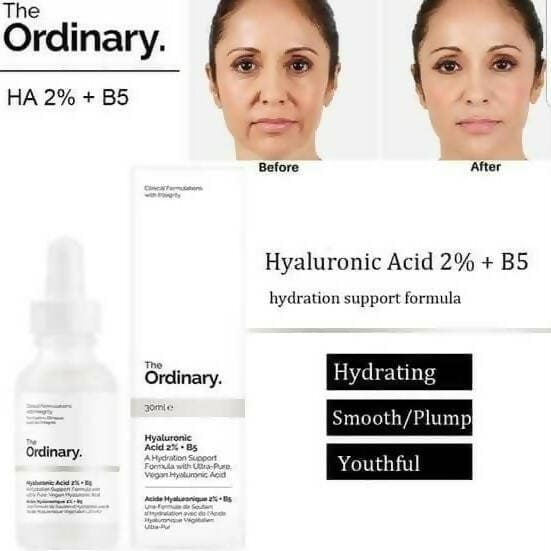 The Ordinary Hyaluronic Acid 2% + B5 - 30ml Moisturizer - XOXO cosmetics